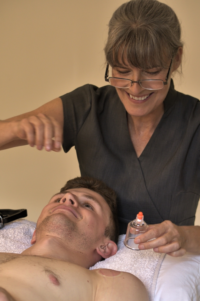 cupping demonstration on shoulder