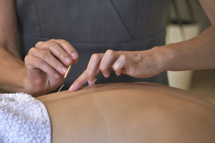 practitioner inserts acupuncture needle in lower back